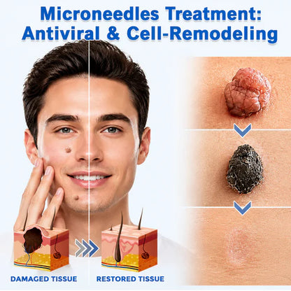 🌿2-in-1 Microneedle & Hydrocolloid Patch & Invisible Face & Body Patches for Raised Moles, Acne, Flat Warts & Skin Tags - Helps Improve the Appearance of Wrinkles, Scars & Blemishes