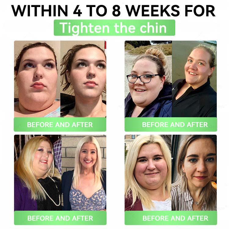 🌙 Vilnexa™ 8-in-1 AMPK Metabolic Slimming Patch 🇺🇸 Moringa × Berberine Formula · Supports Weight Management, Metabolic Balance & Daily Comfort
