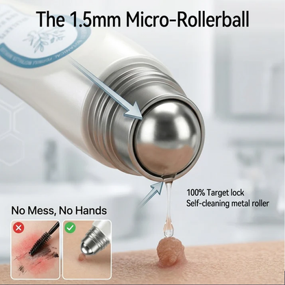 𝟕-𝐃𝒂𝘆 𝐒𝗸𝐢𝐧 𝐓𝒂𝗴 & 𝐒𝐩𝙤𝐭 𝐄𝐫𝒂𝐬𝙚𝐫,Painless & Scar-Free  Advanced Imperfection Removal Rollerball Pen
