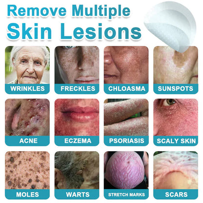🌿2-in-1 Microneedle & Hydrocolloid Patch & Invisible Face & Body Patches for Raised Moles, Acne, Flat Warts & Skin Tags - Helps Improve the Appearance of Wrinkles, Scars & Blemishes