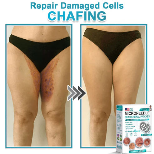 2-in-1 Microneedle & Hydrocolloid Patch 🌿 Invisible Face & Body Patches for Raised Moles, Acne, Flat Warts & Skin Tags - Helps Improve the Appearance of Wrinkles, Scars & Blemishes
