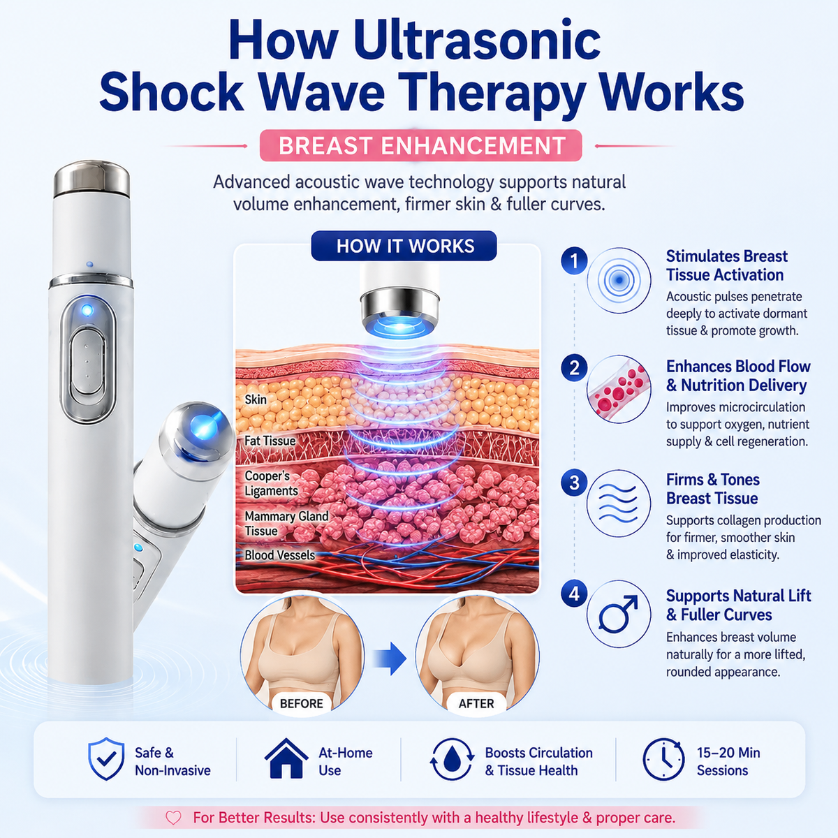 NATRAVOR® Breast Enhancement Laser Pen – Lift, Firm & Contour Support